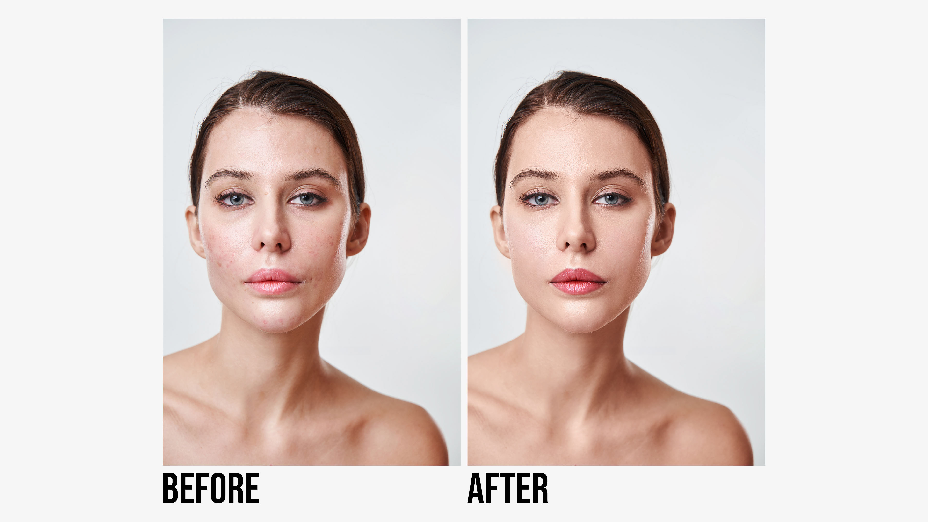 Skin Retouching